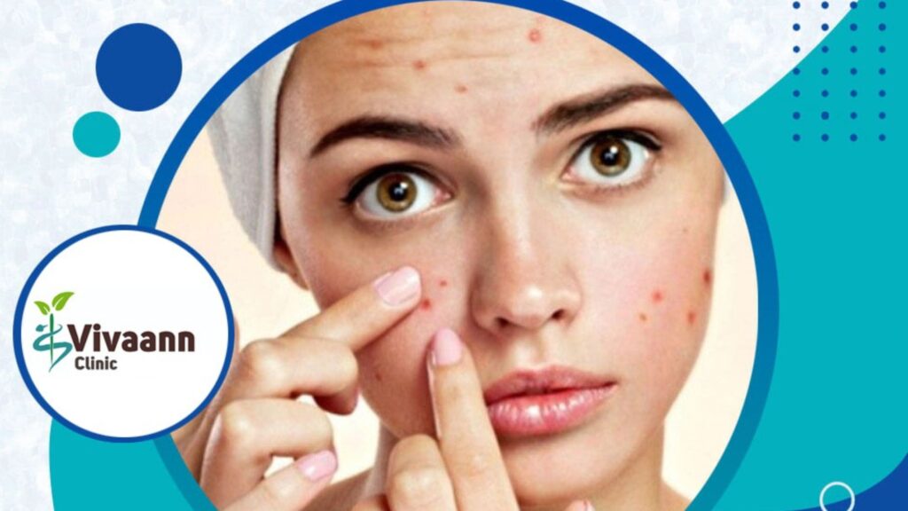 Skin Allergies