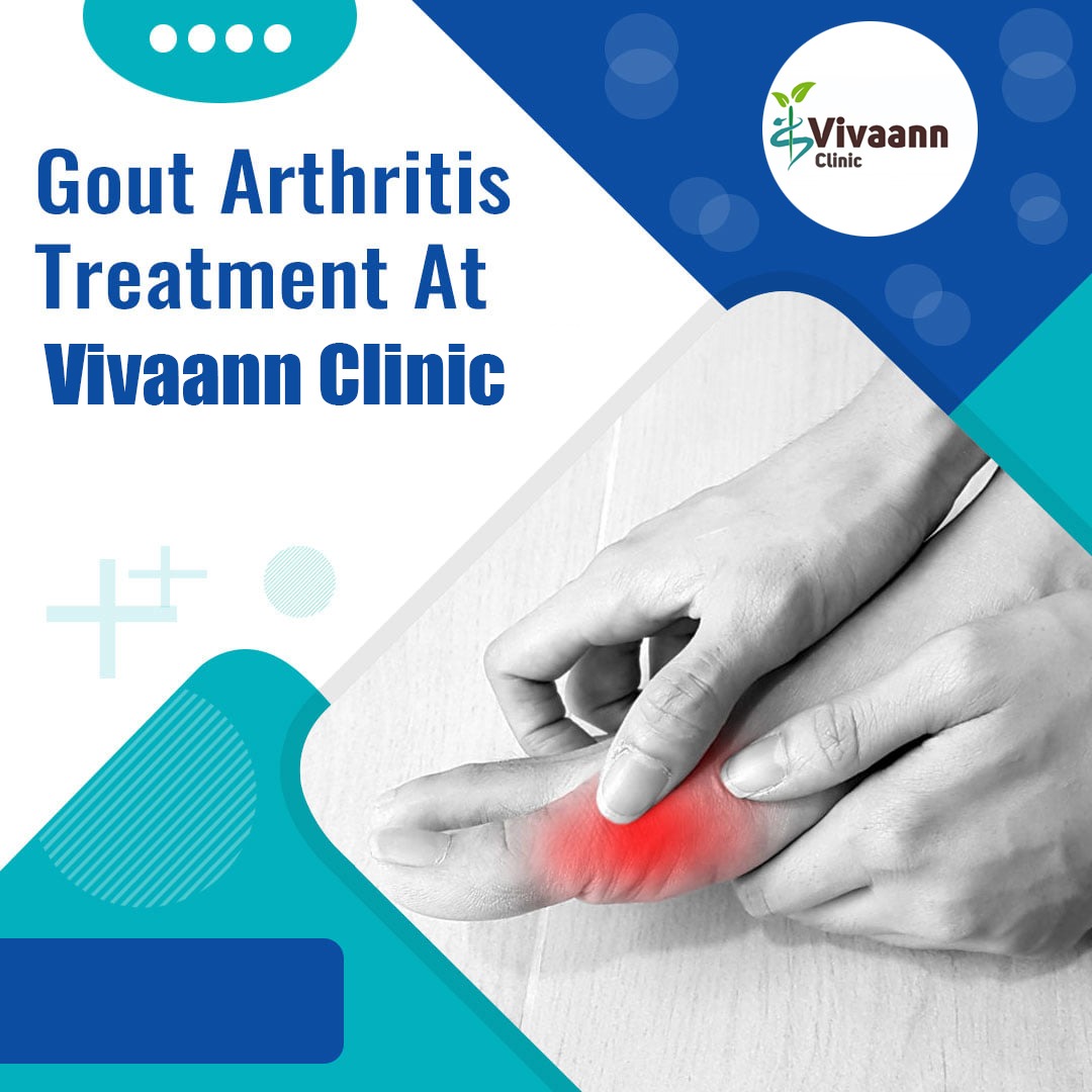 Gout Arthritis