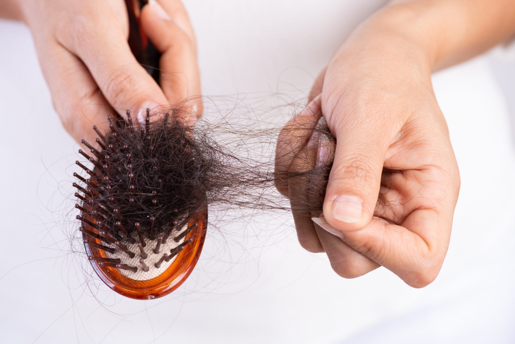 Hair Falling