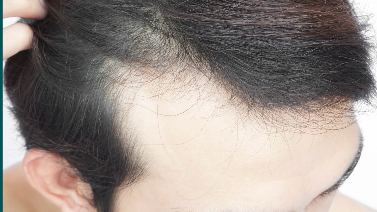 Why Your Hair Fall Won’t Stop – The 5 Hidden Triggers Nobody Tells You